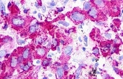 P2Y1 Polyclonal Antibody:Antibodies, Polyclonal