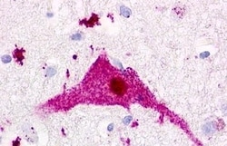 P2Y1 Polyclonal Antibody:Antibodies, Polyclonal