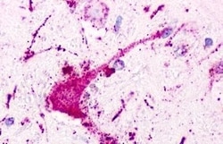 P2Y1 Polyclonal Antibody:Antibodies, Polyclonal