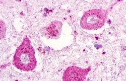 Invitrogen P2Y1 Polyclonal Antibody 50 &mu;g | Buy Online | Invitrogen&trade; | Fisher Scientific