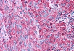 Invitrogen P2Y4 Polyclonal Antibody 50 &mu;g | Buy Online | Invitrogen&trade; | Fisher Scientific