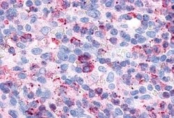 Invitrogen P2Y6 Polyclonal Antibody 50 &mu;g; Unconjugated:Antibodies,