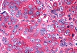 Invitrogen P2Y6 Polyclonal Antibody 50 &mu;g; Unconjugated:Antibodies,