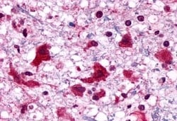 Invitrogen P2Y6 Polyclonal Antibody 50 &mu;g; Unconjugated:Antibodies,