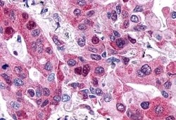 Invitrogen P2Y6 Polyclonal Antibody 50 &mu;g; Unconjugated:Antibodies,