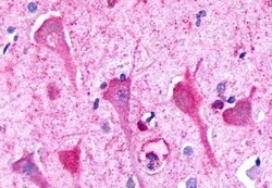 Invitrogen P2Y8 Polyclonal Antibody 50 &mu;g; Unconjugated:Antibodies,