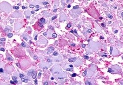 Invitrogen P2Y8 Polyclonal Antibody 50 &mu;g; Unconjugated:Antibodies,