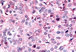 Invitrogen PAK6 Polyclonal Antibody 50 &mu;g; Unconjugated:Antibodies,