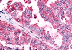 Invitrogen PAK6 Polyclonal Antibody 50 &mu;g; Unconjugated:Antibodies,