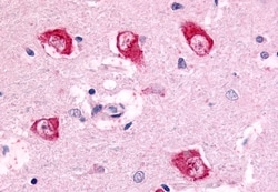 Invitrogen PAK7 Polyclonal Antibody 50 &mu;g; Unconjugated:Antibodies,