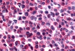 Invitrogen PAK7 Polyclonal Antibody 50 &mu;g; Unconjugated:Antibodies,