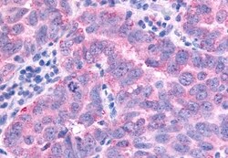 Invitrogen PAK7 Polyclonal Antibody 50 &mu;g; Unconjugated:Antibodies,