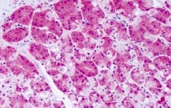 Invitrogen PRKD2 Polyclonal Antibody 50 &mu;g; Unconjugated:Antibodies,