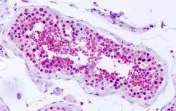 Invitrogen PRKD2 Polyclonal Antibody 50 &mu;g; Unconjugated:Antibodies,