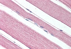 Invitrogen Prokineticin Receptor 1 Polyclonal Antibody 50 &mu;g; Unconjugated:Antibodies,