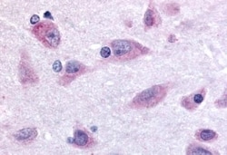 Invitrogen Prokineticin Receptor 2 Polyclonal Antibody 50 &mu;g; Unconjugated:Antibodies,