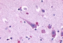 Prokineticin Receptor 2 Polyclonal Antibody:Antibodies, Polyclonal