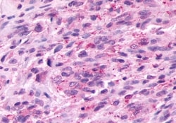 Prokineticin Receptor 2 Polyclonal Antibody:Antibodies, Polyclonal