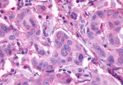 Prokineticin Receptor 2 Polyclonal Antibody:Antibodies, Polyclonal