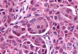 Prokineticin Receptor 2 Polyclonal Antibody:Antibodies, Polyclonal