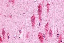PTGER3 Polyclonal Antibody:Antibodies, Polyclonal
