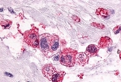 PTGER3 Polyclonal Antibody:Antibodies, Polyclonal