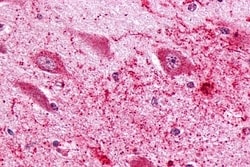 PTGER3 Polyclonal Antibody:Antibodies, Polyclonal