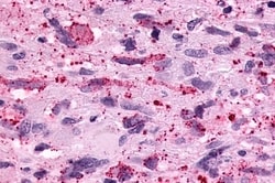 PTGER3 Polyclonal Antibody:Antibodies, Polyclonal