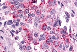 PTGER3 Polyclonal Antibody:Antibodies, Polyclonal