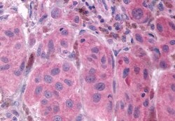 Invitrogen PTGFR Polyclonal Antibody 50 &mu;g; Unconjugated:Antibodies,