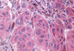 Invitrogen PTGFR Polyclonal Antibody 50 &mu;g; Unconjugated:Antibodies,