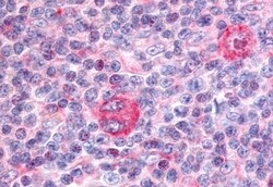 Invitrogen PTPRE Polyclonal Antibody 50 &mu;g | Buy Online | Invitrogen&trade; | Fisher Scientific