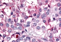 Invitrogen PTPRE Polyclonal Antibody 50 &mu;g | Buy Online | Invitrogen&trade; | Fisher Scientific