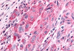 Invitrogen PTPRE Polyclonal Antibody 50 &mu;g | Buy Online | Invitrogen&trade; | Fisher Scientific