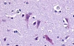 Invitrogen QRFPR Polyclonal Antibody 50 &mu;g | Buy Online | Invitrogen&trade; | Fisher Scientific