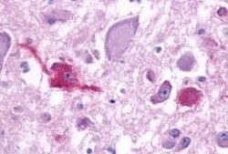 Invitrogen QRFPR Polyclonal Antibody 50 &mu;g | Buy Online | Invitrogen&trade; | Fisher Scientific