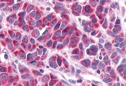 Invitrogen RORA Polyclonal Antibody 50 &mu;g; Unconjugated:Antibodies,