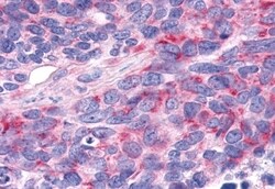 Invitrogen RORA Polyclonal Antibody 50 &mu;g; Unconjugated:Antibodies,