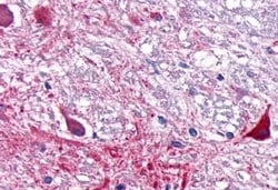 Invitrogen RORA Polyclonal Antibody 50 &mu;g; Unconjugated:Antibodies,