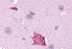 Invitrogen RORA Polyclonal Antibody 50 &mu;g; Unconjugated:Antibodies,