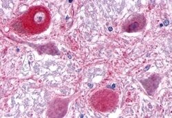 Invitrogen RORA Polyclonal Antibody 50 &mu;g; Unconjugated:Antibodies,