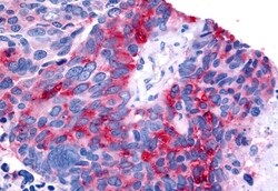 Invitrogen RORB Polyclonal Antibody 50 &mu;g | Buy Online | Invitrogen&trade; | Fisher Scientific