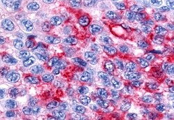 Invitrogen RORB Polyclonal Antibody 50 &mu;g | Buy Online | Invitrogen&trade; | Fisher Scientific
