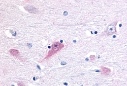 Invitrogen RORB Polyclonal Antibody 50 &mu;g | Buy Online | Invitrogen&trade; | Fisher Scientific