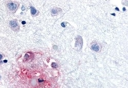 Invitrogen RORB Polyclonal Antibody 50 &mu;g | Buy Online | Invitrogen&trade; | Fisher Scientific