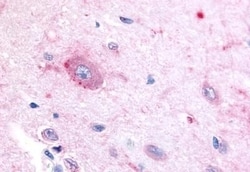 Invitrogen RORB Polyclonal Antibody 50 &mu;g | Buy Online | Invitrogen&trade; | Fisher Scientific