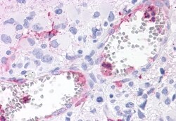 Invitrogen ROR gamma Polyclonal Antibody 50 &mu;g; Unconjugated:Antibodies,
