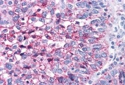 Invitrogen ROR gamma Polyclonal Antibody 50 &mu;g; Unconjugated:Antibodies,