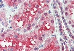 Invitrogen SLC44A2 Polyclonal Antibody 50 &mu;g; Unconjugated:Antikroppar