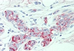 Invitrogen SLC4A2 Polyclonal Antibody 50 &mu;g; Unconjugated:Antibodies,